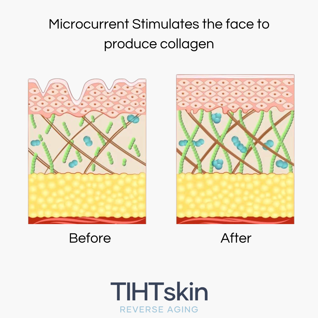 Microcurrent Facial Device